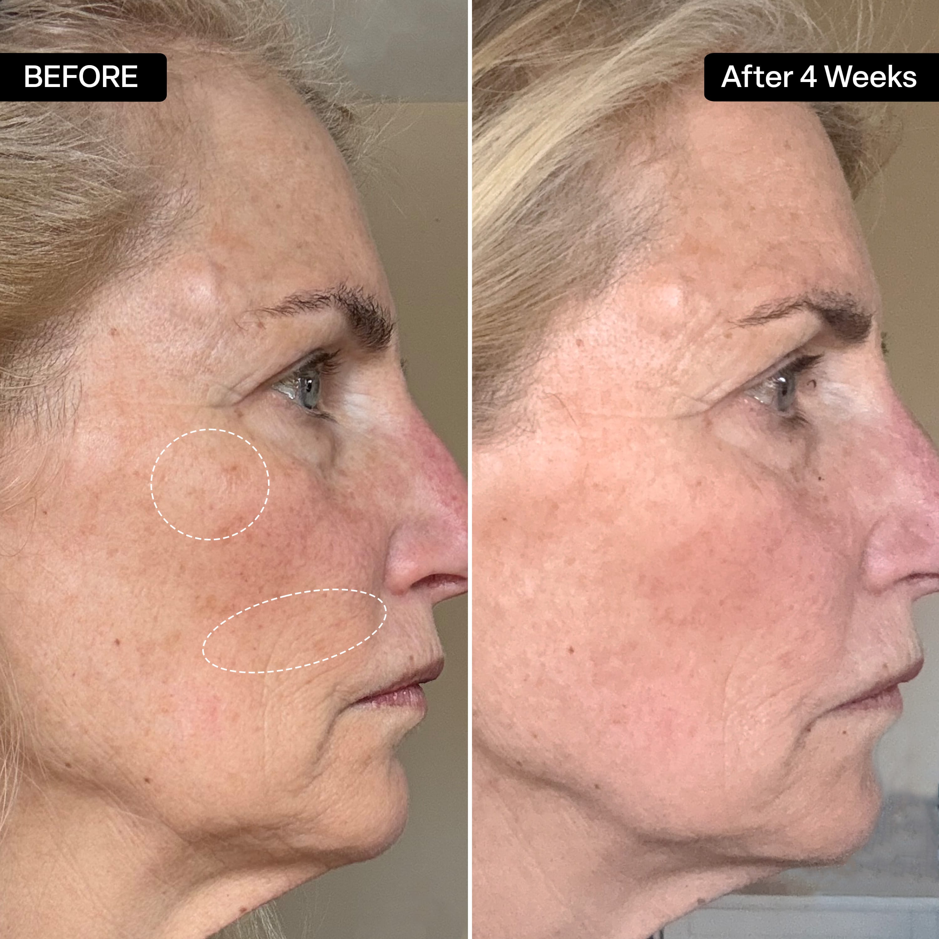 5% Niacinamide + 1% Retinol Serum