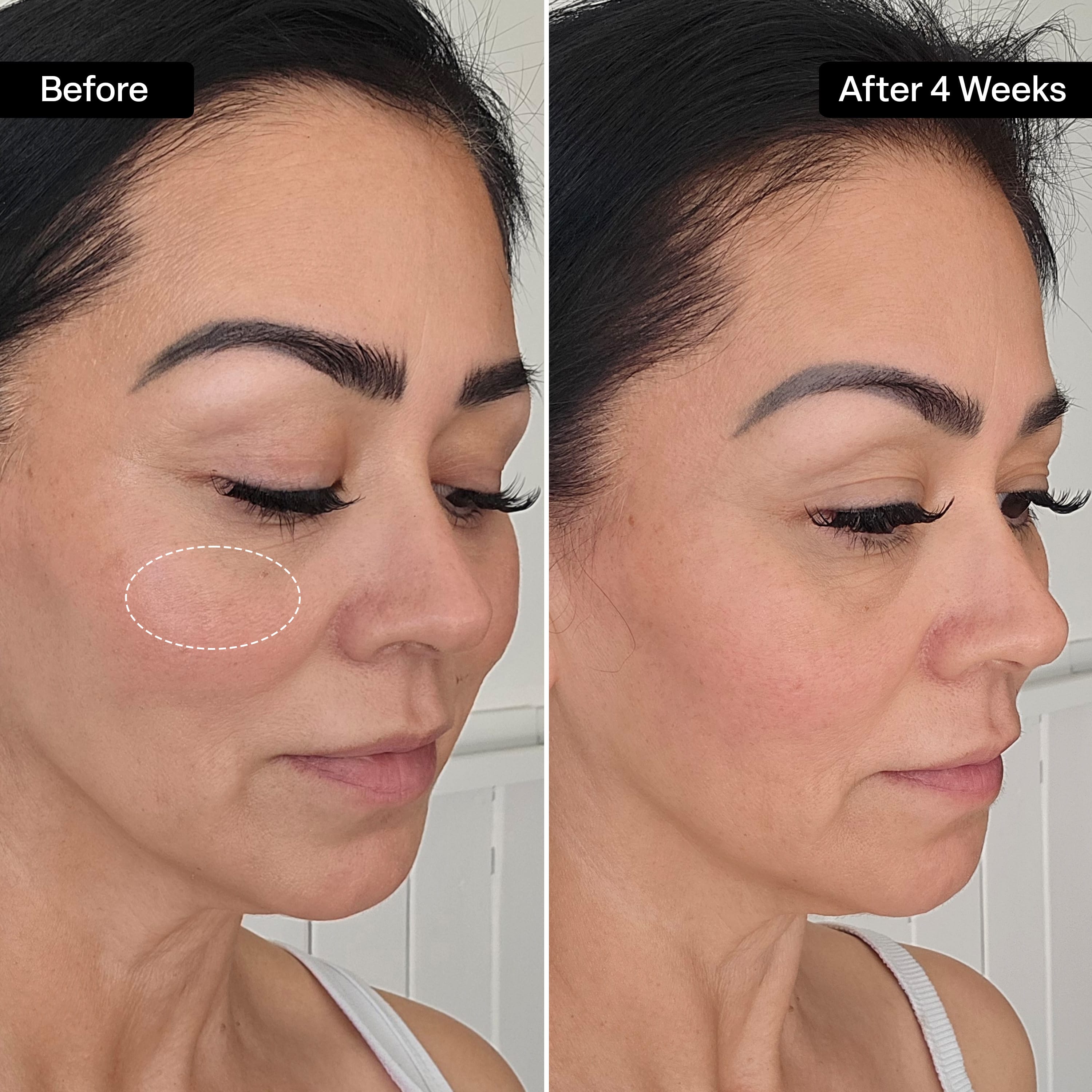 Squalane HA+ Moisturizing Cream