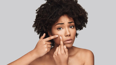 Dry Skin Breakouts: How to Treat Acne When You Have Dry Skin