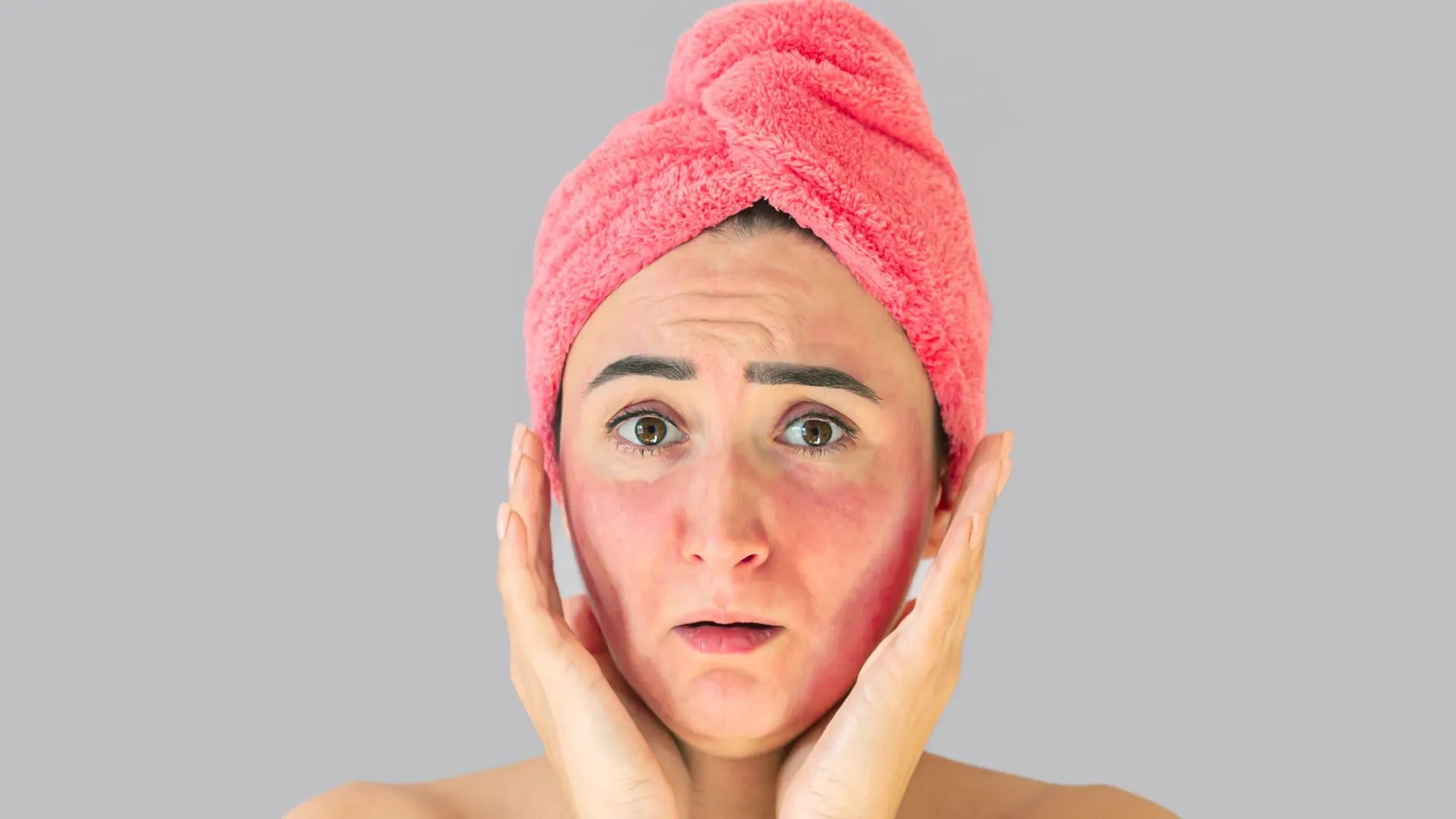 Fastest Ways to Eliminate Facial Red Spots: Effective Natural Home Remedies