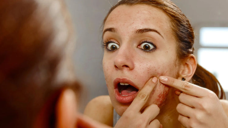 Exploding Infected Pimples What's Inside a Pimple? Exploring the Causes, Treatment, and Preventio ...