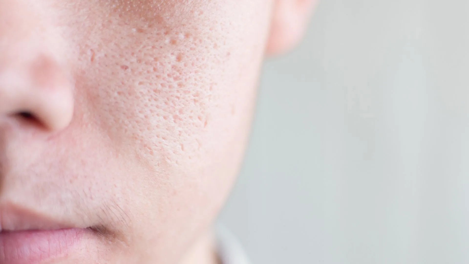 Unveiling the Causes and Remedies for Enlarged Pores: Unraveling the Truth