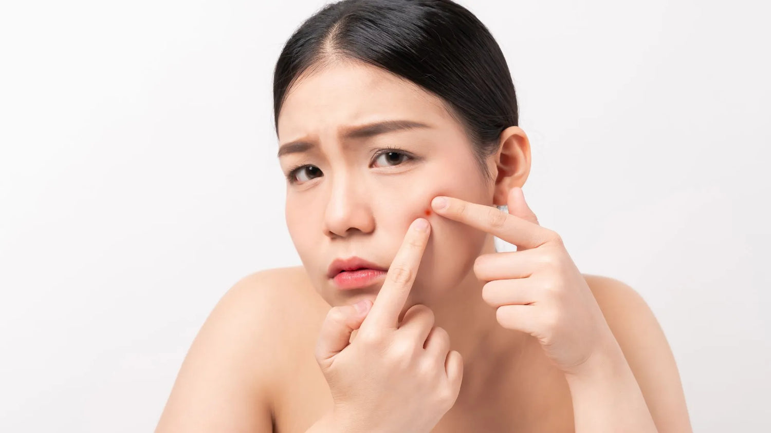 Spot Duration Without Popping: Uncovering the Lifespan of Unblemished Skin