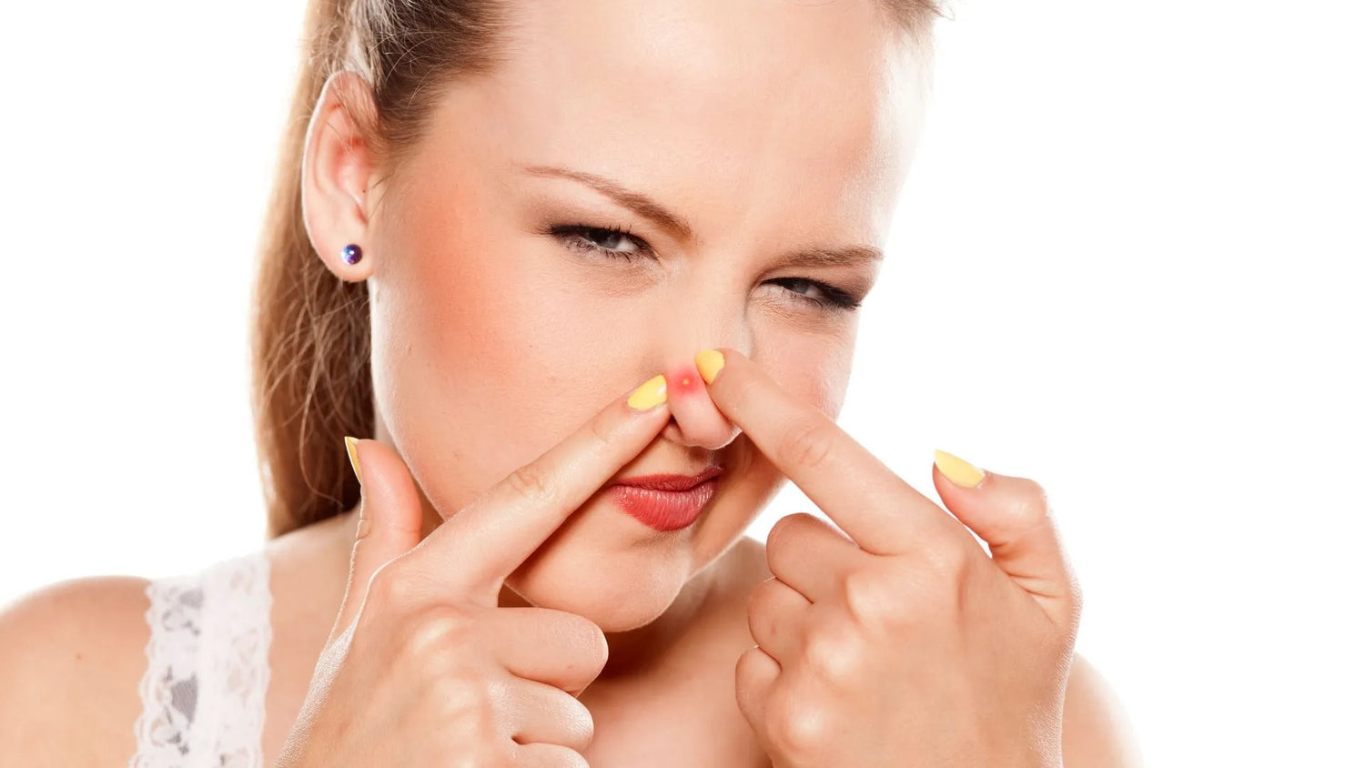 Nasal pimple removal: Effective tips to eliminate nose acne