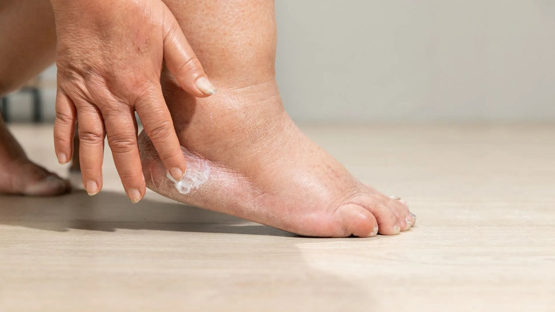 Is Shea Butter Good for Feet? – QRxLabs
