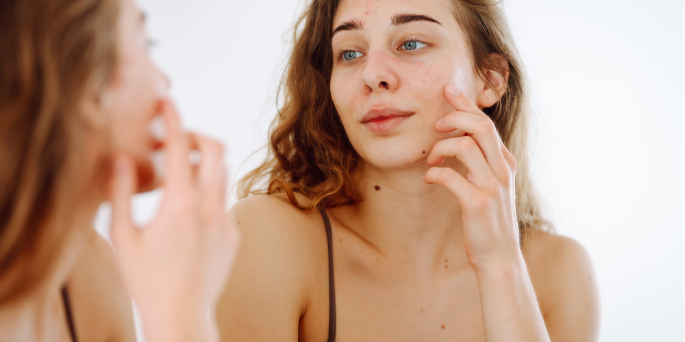 Liquid Microneedling Explained: Needle-Level Results Without the Downtime