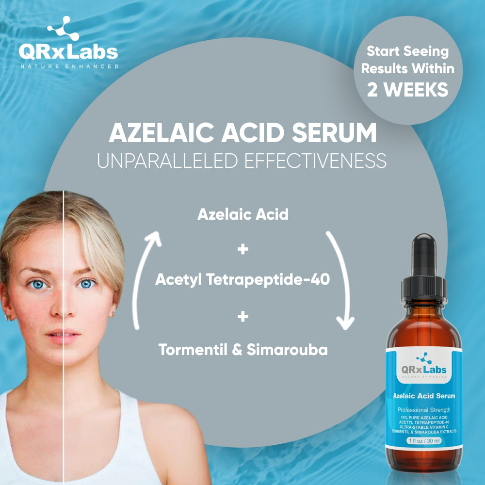 Azelaic Acid Serum