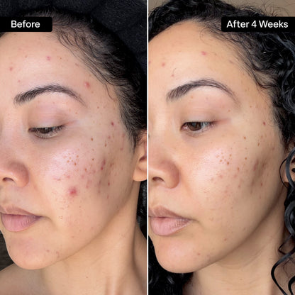 20% Glycolic Acid Resurfacing Pads