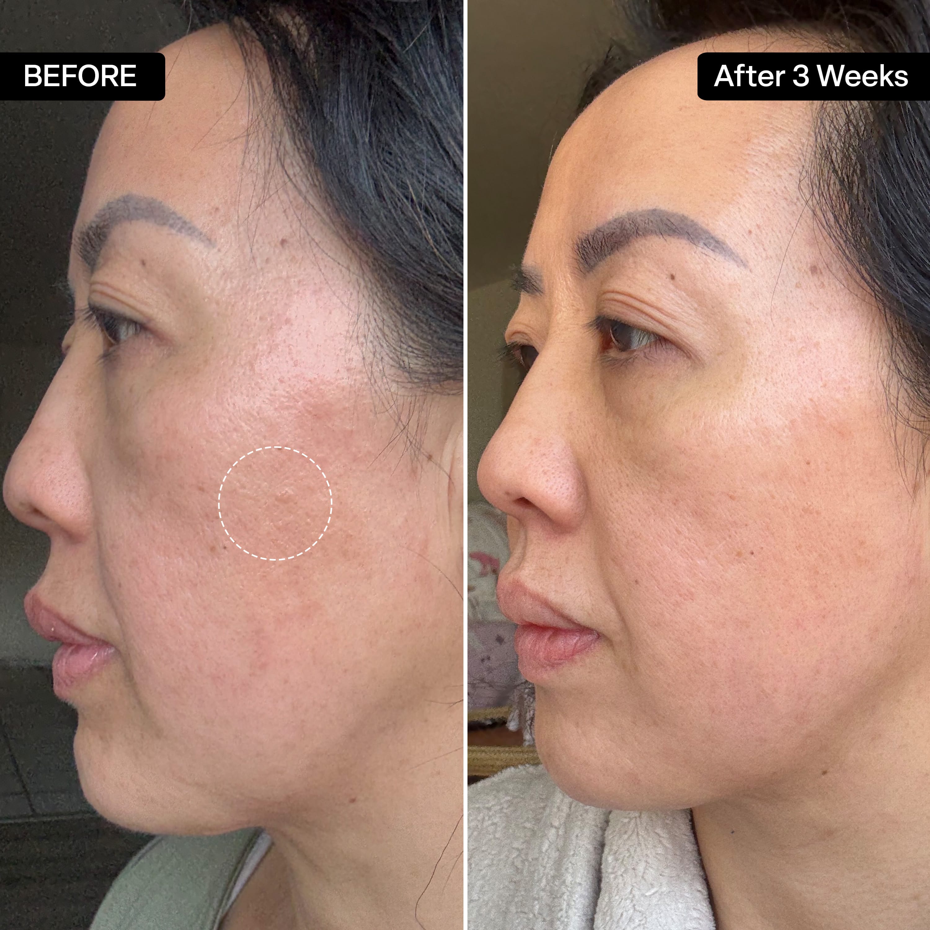 Glycolic Acid Gel Cleanser – QRxLabs