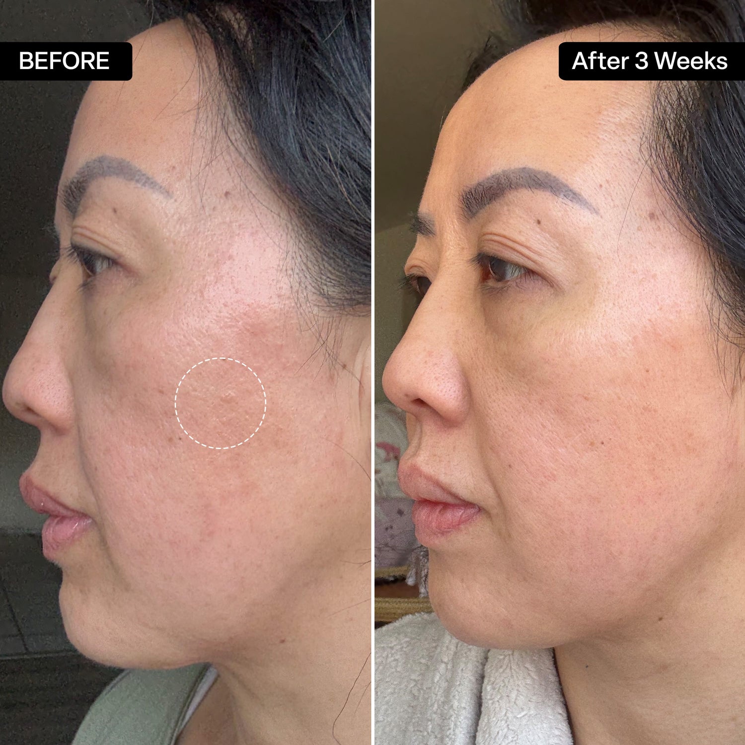 Glycolic Acid Gel Cleanser