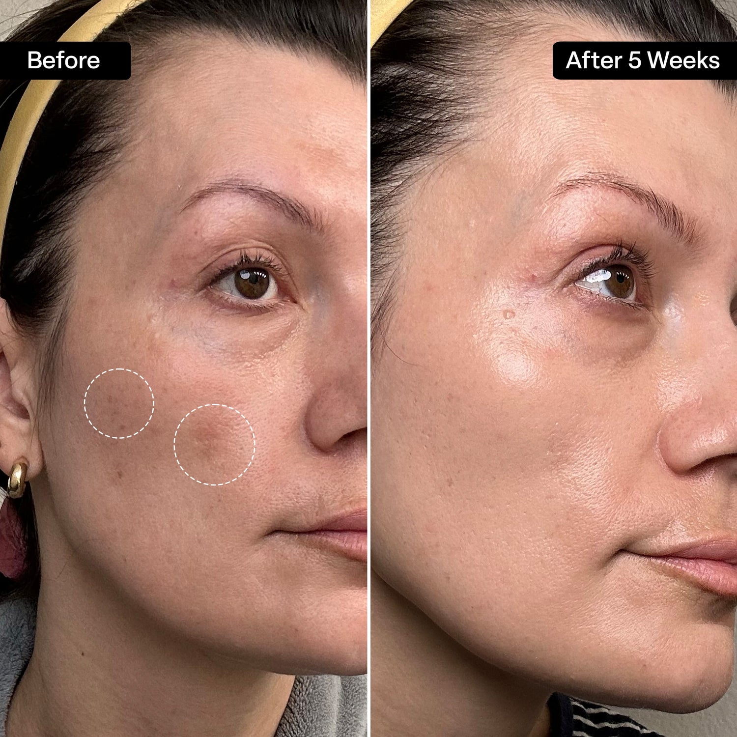 Pore Refining Toner Pads